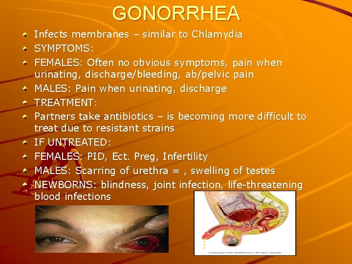 GONORRHEA Infects membranes – similar to Chlamydia SYMPTOMS: FEMALES: Often no obvious symptoms, pain
