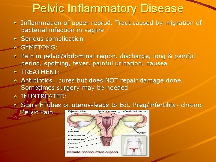 Pelvic Inflammatory Disease Inflammation of upper reprod. Tract caused by migration of bacterial infection