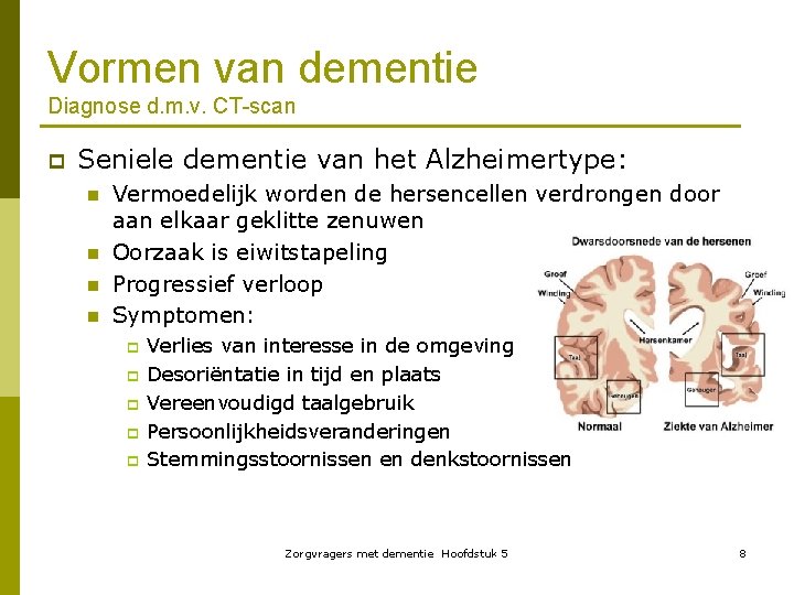 Vormen van dementie Diagnose d. m. v. CT-scan p Seniele dementie van het Alzheimertype: