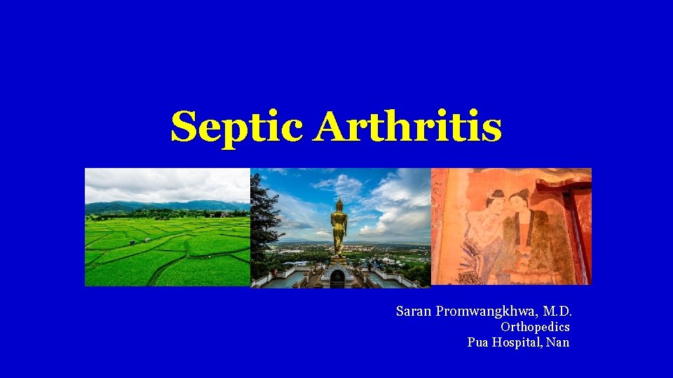 Septic Arthritis Saran Promwangkhwa, M. D. Orthopedics Pua Hospital, Nan 