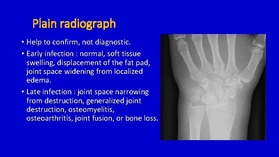 Plain radiograph • Help to confirm, not diagnostic. • Early infection : normal, soft