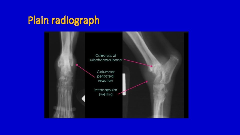 Plain radiograph 