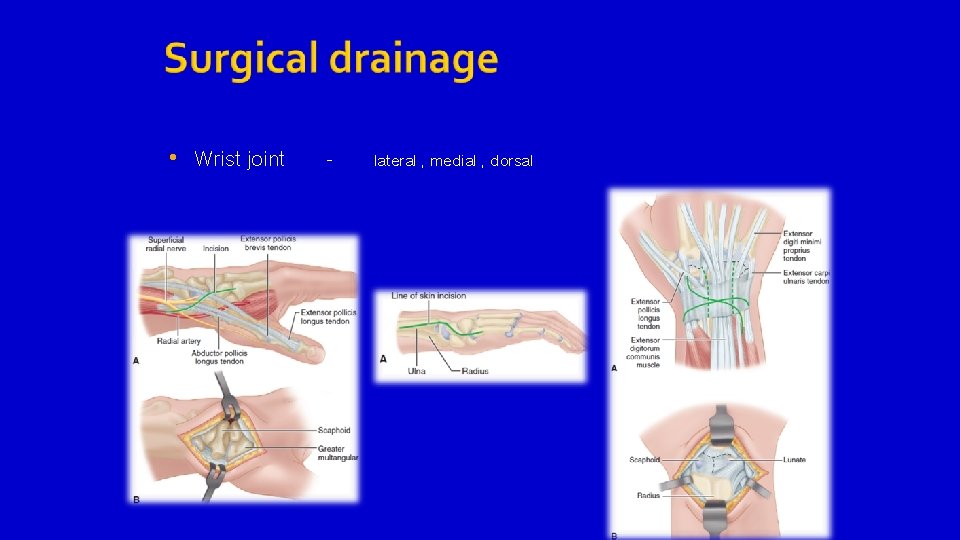  • Wrist joint - lateral , medial , dorsal 