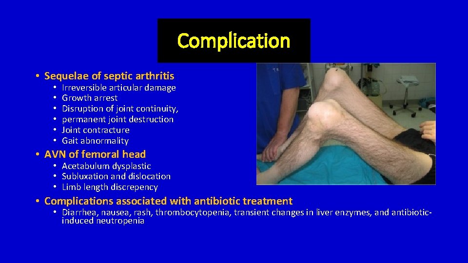 Complication • Sequelae of septic arthritis • • • Irreversible articular damage Growth arrest