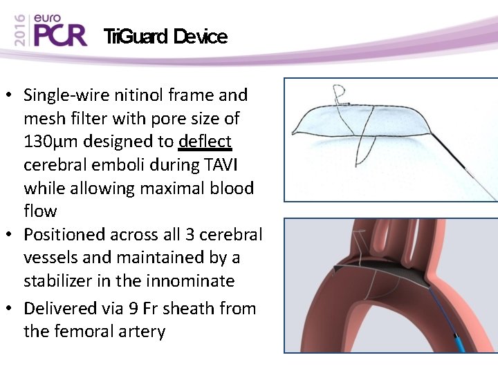 Tri. Guard Device • Single-wire nitinol frame and mesh filter with pore size of