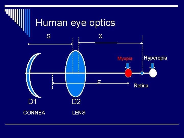Human eye optics S X Myopia F D 1 CORNEA D 2 LENS Hyperopia Human eye optics S X Myopia F D 1 CORNEA D 2 LENS Hyperopia