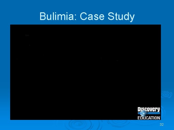 Bulimia: Case Study 32 