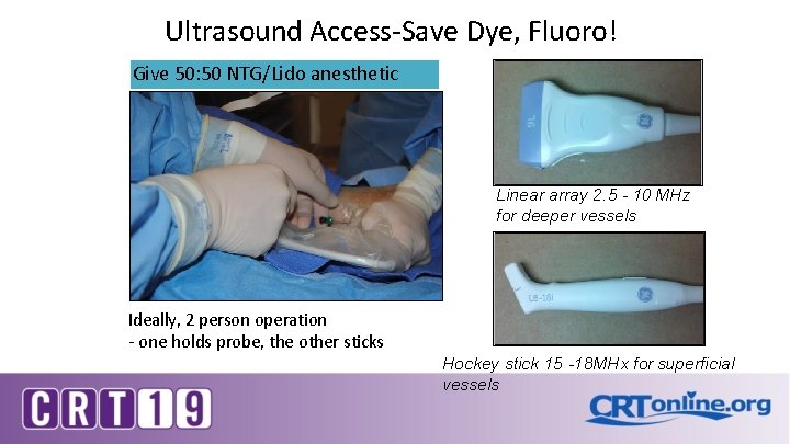 Ultrasound Access-Save Dye, Fluoro! Give 50: 50 NTG/Lido anesthetic Linear array 2. 5 -