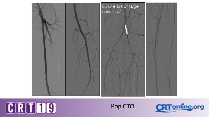 CTO ends in large collateral Pop CTO 