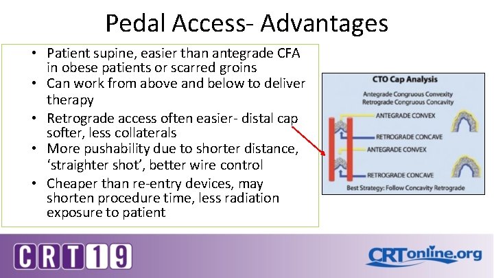 Pedal Access- Advantages • Patient supine, easier than antegrade CFA in obese patients or