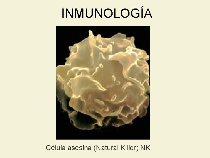 INMUNOLOGÍA Célula asesina (Natural Killer) NK 