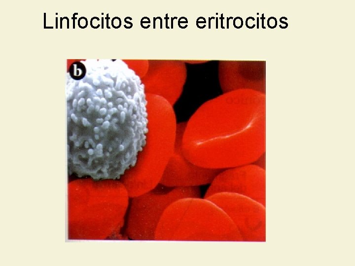 Linfocitos entre eritrocitos 