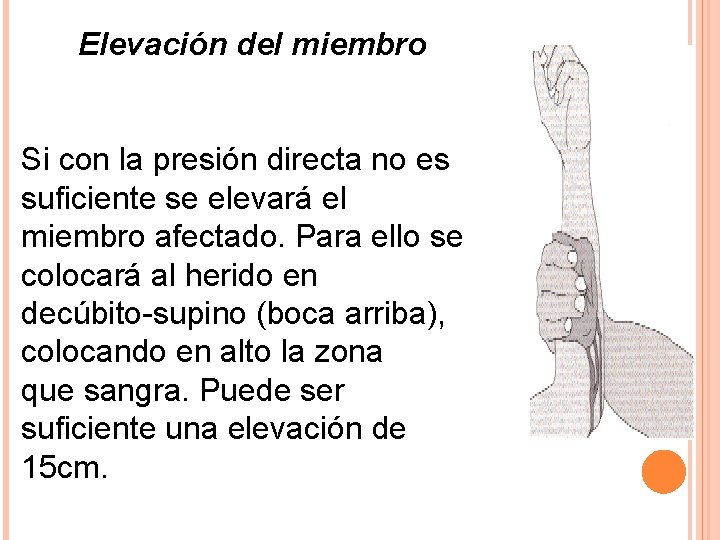 Elevación del miembro Si con la presión directa no es suficiente se elevará el