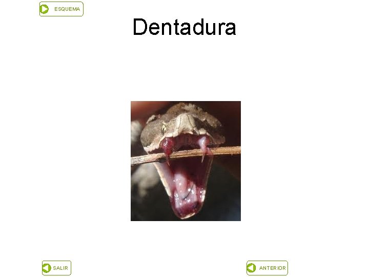 ESQUEMA Dentadura SALIR ANTERIOR 