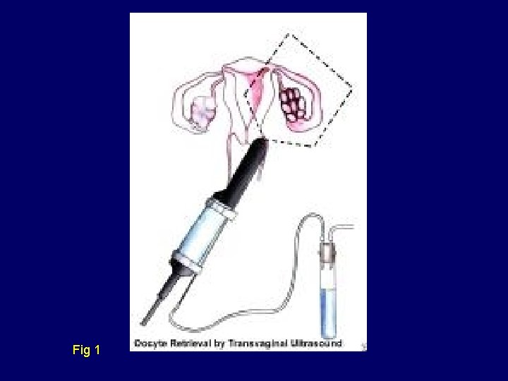 Fig 1 