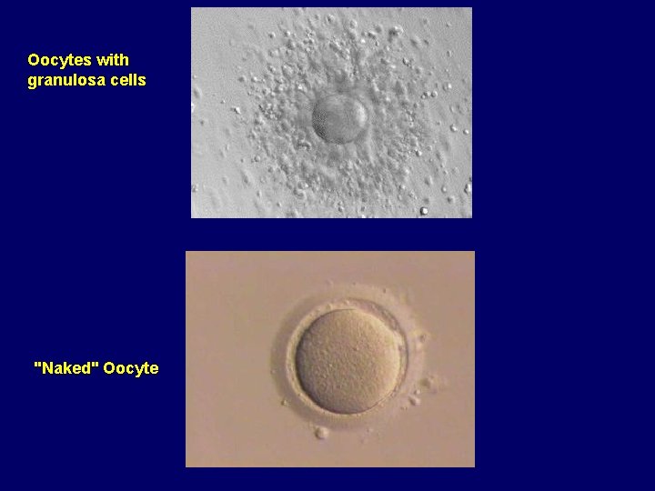 Oocytes with granulosa cells "Naked" Oocyte 