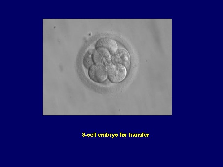 8 -cell embryo for transfer 