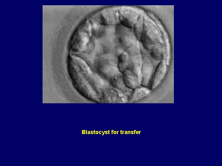 Blastocyst for transfer 