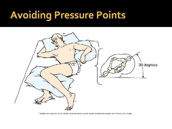 Avoiding Pressure Points 