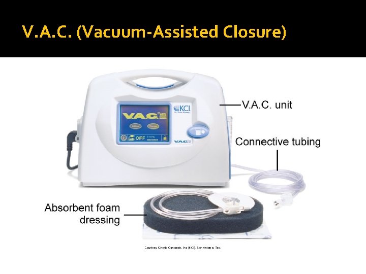 V. A. C. (Vacuum-Assisted Closure) 