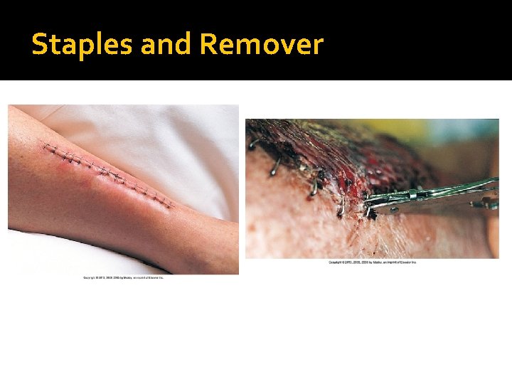 Staples and Remover 