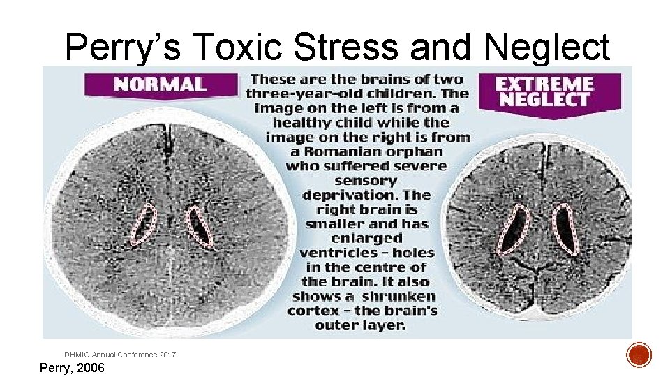 Perry’s Toxic Stress and Neglect DHMIC Annual Conference 2017 Perry, 2006 