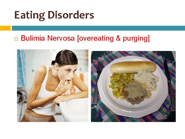 Eating Disorders Bulimia Nervosa [overeating & purging] 