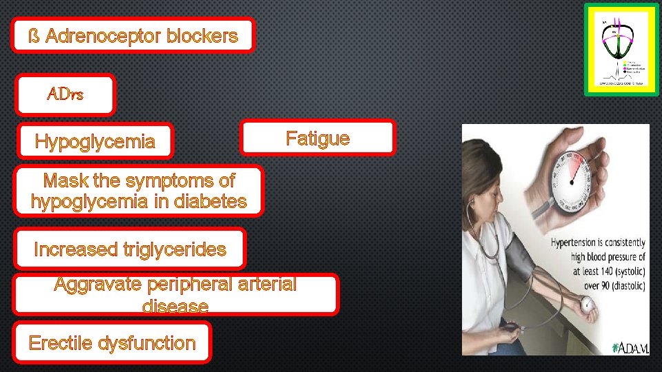 ß Adrenoceptor blockers ADrs Hypoglycemia Fatigue Mask the symptoms of hypoglycemia in diabetes Increased