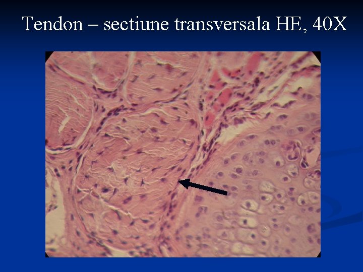 Tendon – sectiune transversala HE, 40 X Tendon – sectiune transversala HE, 40 X