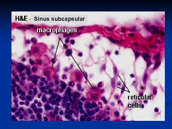 Sinus subcapsular Sinus subcapsular