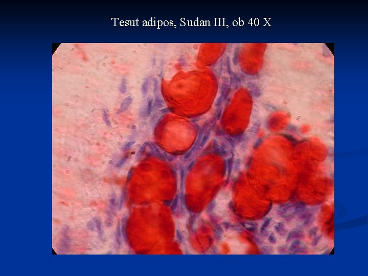 Tesut adipos, Sudan III, ob 40 X Tesut adipos, Sudan III, ob 40 X