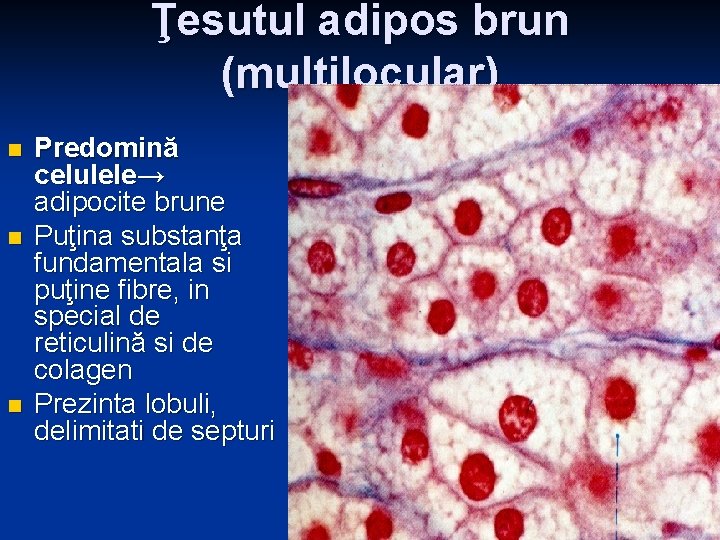 Ţesutul adipos brun (multilocular) n n n Predomină celulele→ adipocite brune Puţina substanţa fundamentala Ţesutul adipos brun (multilocular) n n n Predomină celulele→ adipocite brune Puţina substanţa fundamentala