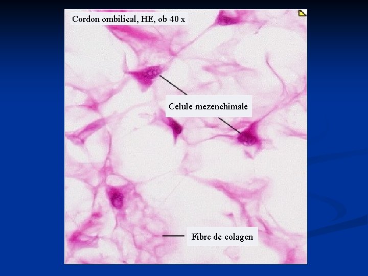 Cordon ombilical, HE, ob 40 x Celule mezenchimale Fibre de colagen Cordon ombilical, HE, ob 40 x Celule mezenchimale Fibre de colagen