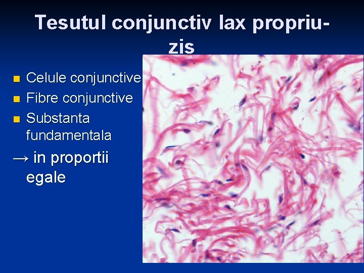 Tesutul conjunctiv lax propriuzis n n n Celule conjunctive Fibre conjunctive Substanta fundamentala → Tesutul conjunctiv lax propriuzis n n n Celule conjunctive Fibre conjunctive Substanta fundamentala →