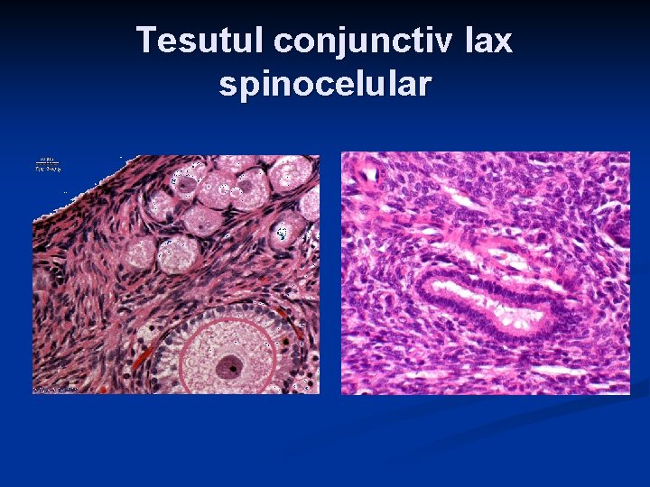 Tesutul conjunctiv lax spinocelular Tesutul conjunctiv lax spinocelular