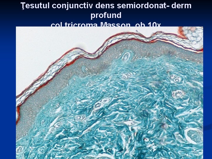 Ţesutul conjunctiv dens semiordonat- derm profund col tricroma Masson, ob 10 x Ţesutul conjunctiv dens semiordonat- derm profund col tricroma Masson, ob 10 x