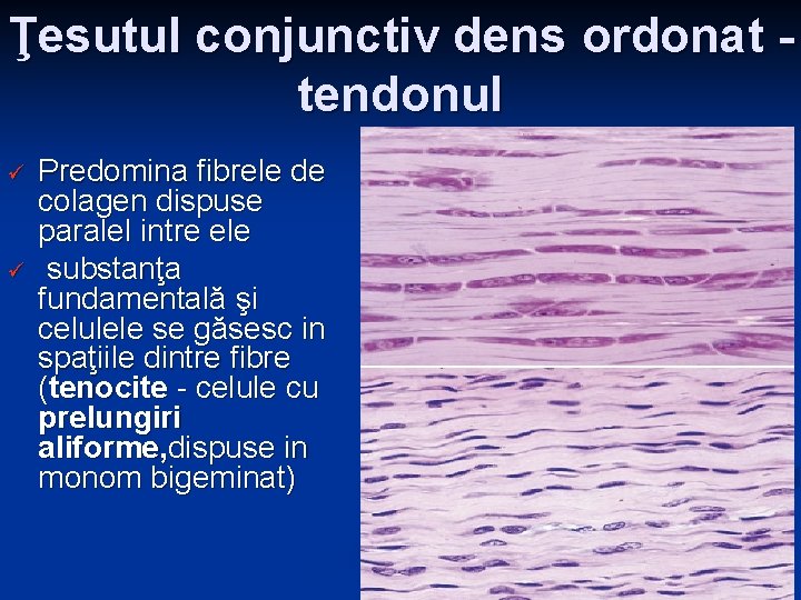 Ţesutul conjunctiv dens ordonat tendonul ü ü Predomina fibrele de colagen dispuse paralel intre Ţesutul conjunctiv dens ordonat tendonul ü ü Predomina fibrele de colagen dispuse paralel intre