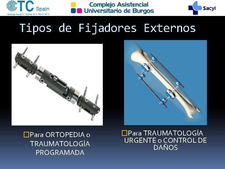 Tipos de Fijadores Externos �Para ORTOPEDIA o TRAUMATOLOGÍA PROGRAMADA �Para TRAUMATOLOGÍA URGENTE o CONTROL