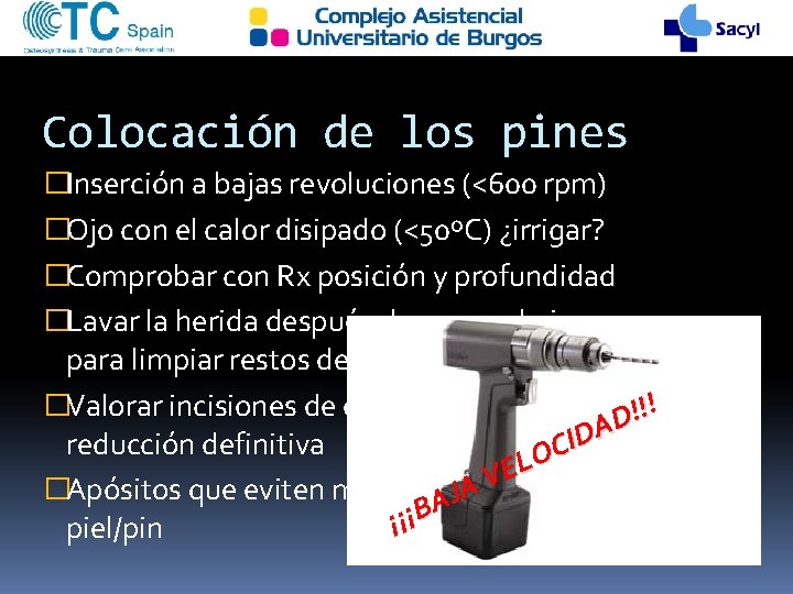 Colocación de los pines �Inserción a bajas revoluciones (<600 rpm) �Ojo con el calor