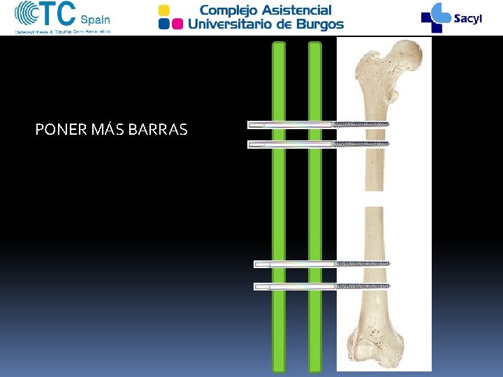 PONER MÁS BARRAS 