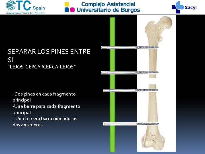 SEPARAR LOS PINES ENTRE SI “LEJOS-CERCA /CERCA-LEJOS” -Dos pines en cada fragmento principal -Una