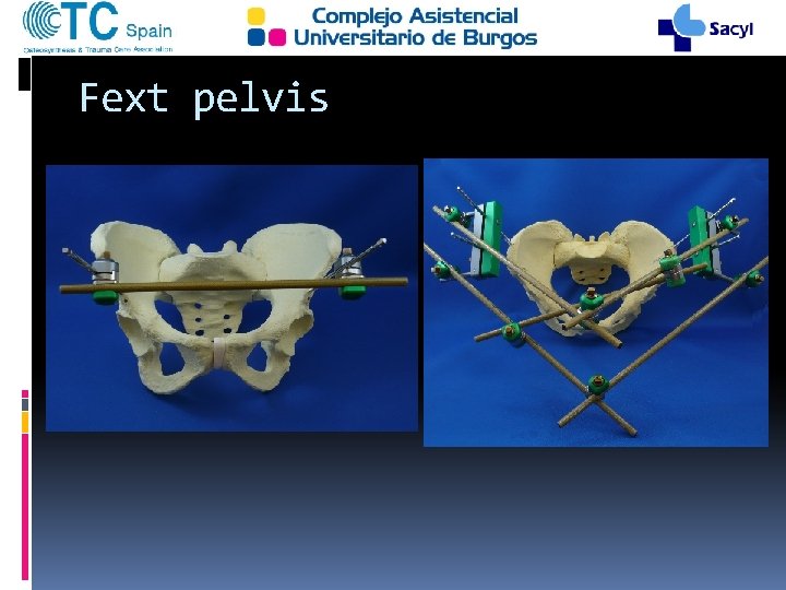 Fext pelvis 
