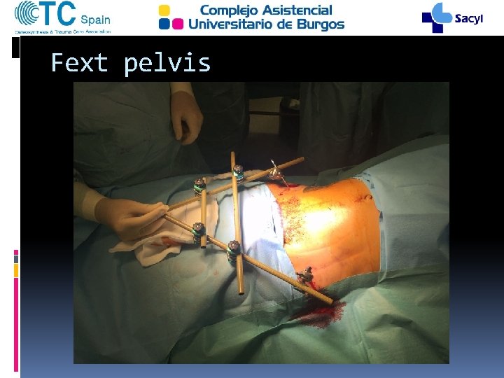 Fext pelvis 