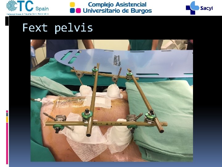 Fext pelvis 