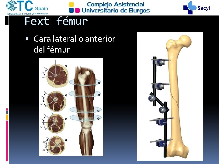 Fext fémur Cara lateral o anterior del fémur 