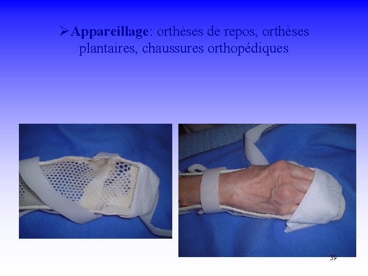 ØAppareillage: orthèses de repos, orthèses plantaires, chaussures orthopédiques 39 
