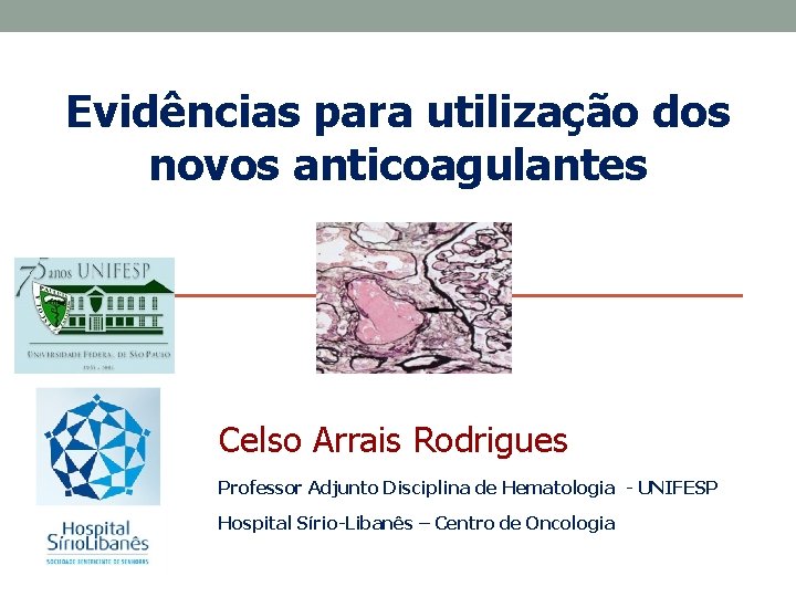 Evidências para utilização dos novos anticoagulantes Celso Arrais Rodrigues Professor Adjunto Disciplina de Hematologia