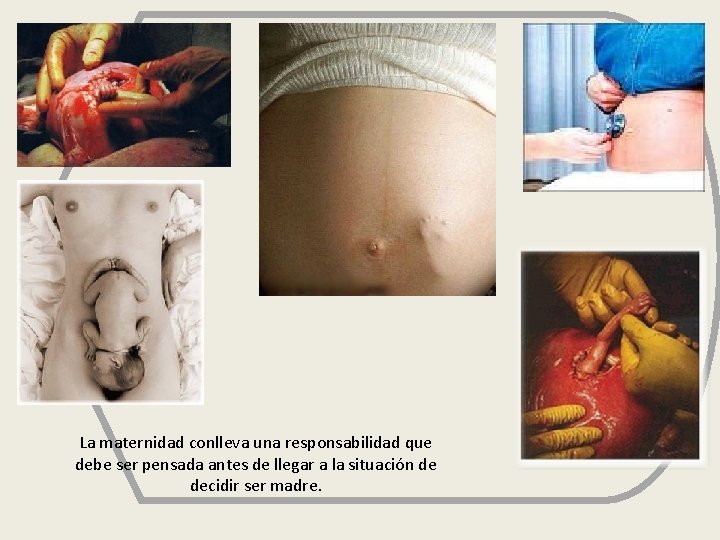 La maternidad conlleva una responsabilidad que debe ser pensada antes de llegar a la