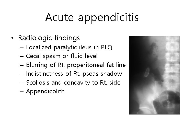 Acute appendicitis • Radiologic findings – – – Localized paralytic ileus in RLQ Cecal Acute appendicitis • Radiologic findings – – – Localized paralytic ileus in RLQ Cecal