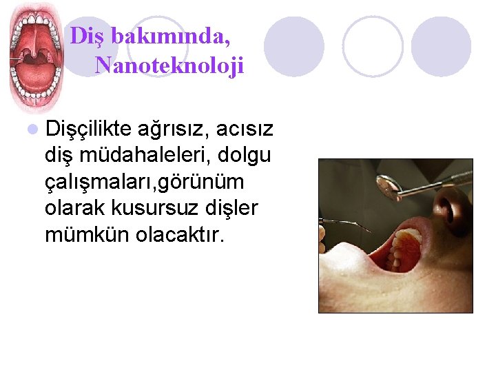 Diş bakımında, Nanoteknoloji l Dişçilikte ağrısız, acısız diş müdahaleleri, dolgu çalışmaları, görünüm olarak kusursuz